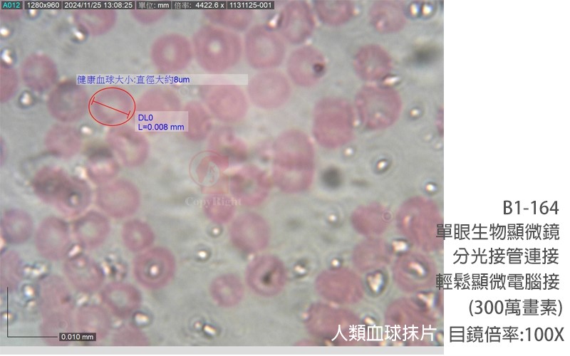 國教儀器,B1-164單眼V型生物顯微鏡觀測人類紅血球抹片(300萬畫素電子目鏡搭配物鏡100X)